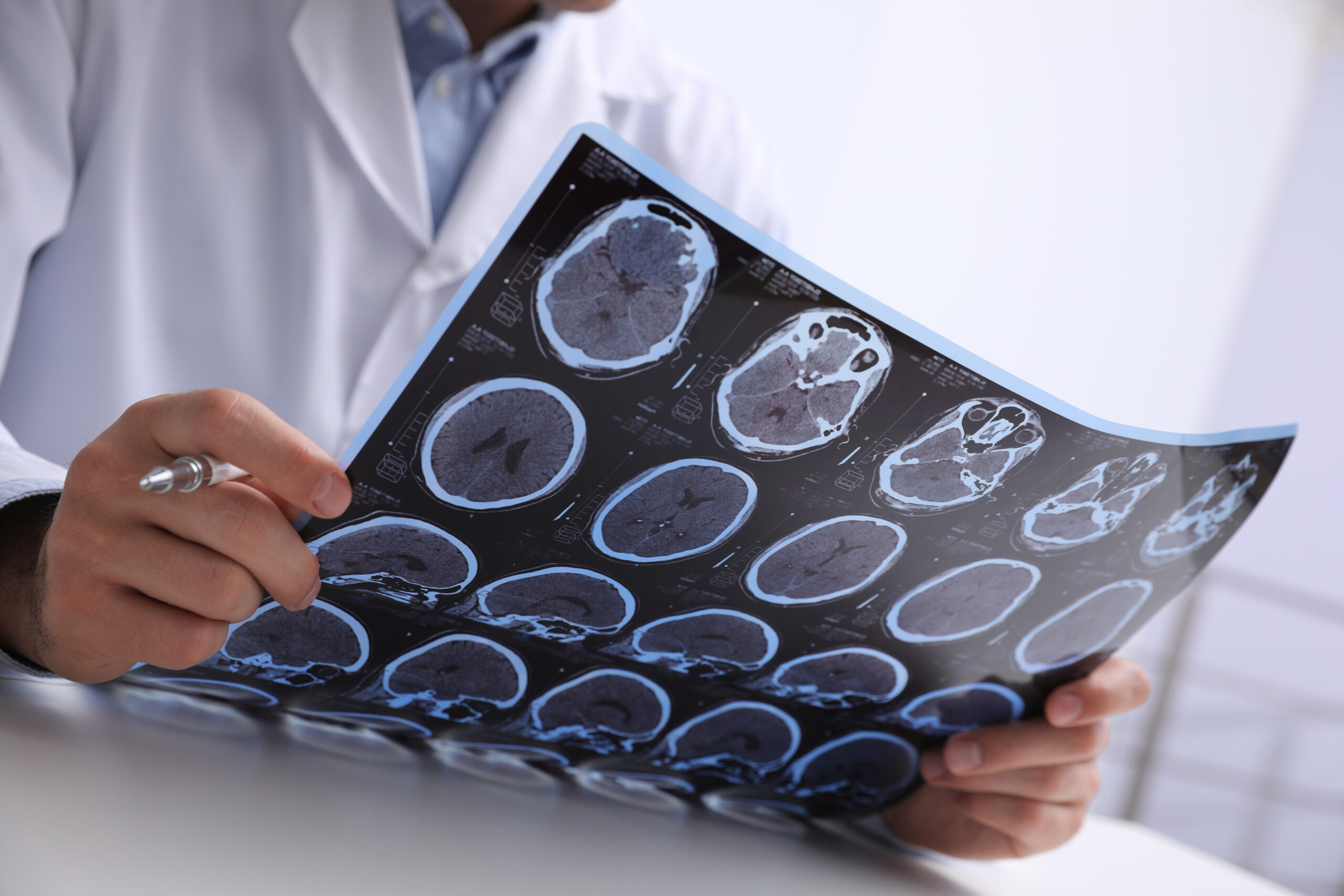 Classification of brain injuries